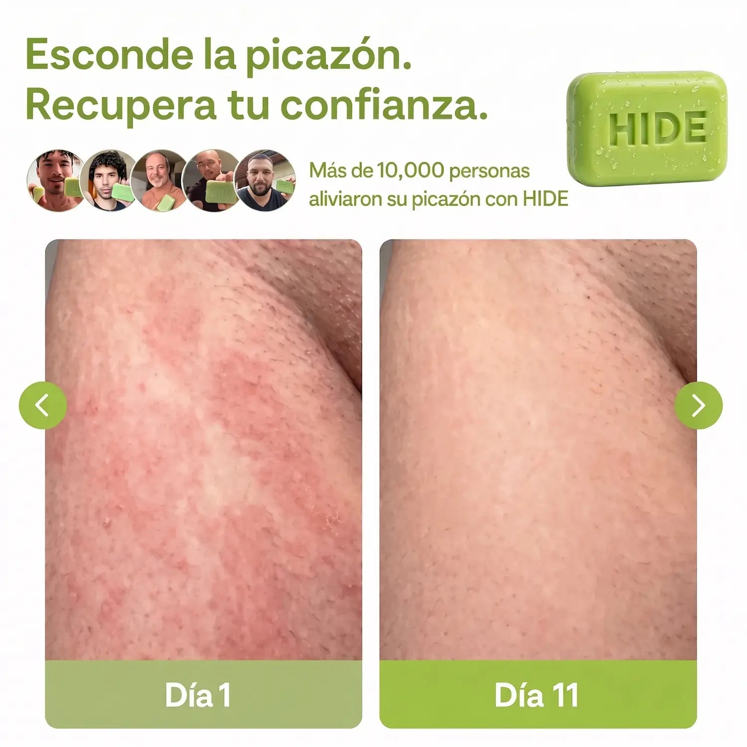HIDE® - Jabón antifúngico